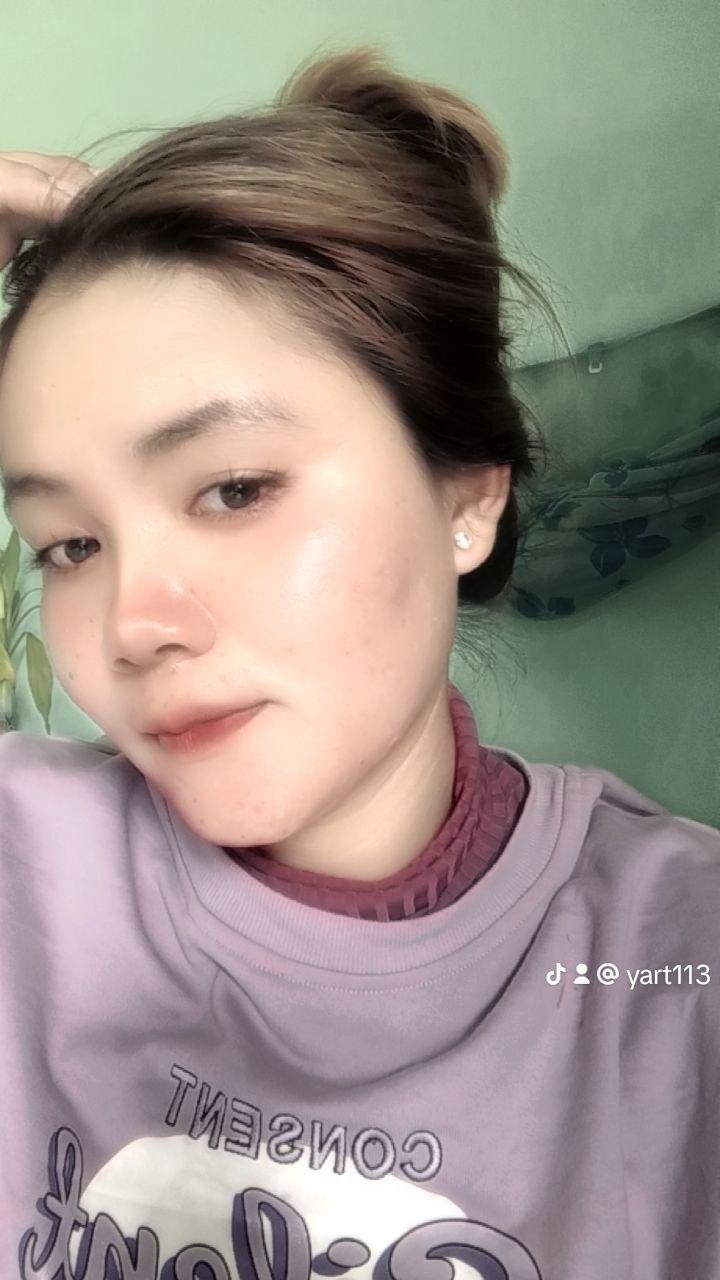 YAT1122 YAT1122